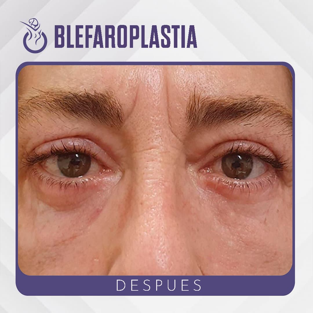 Después