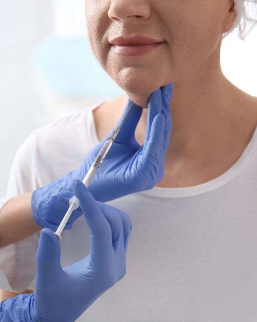 Procedimiento de lipopapada y bichectomía