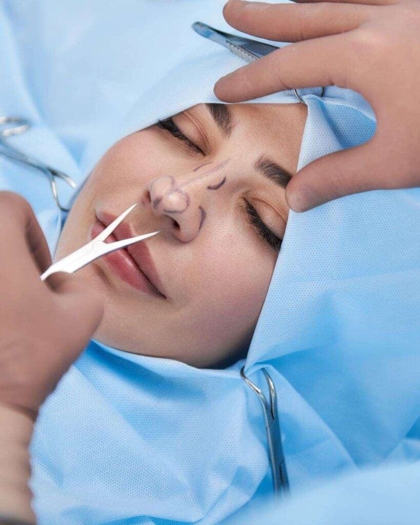 Procedimiento de rinoplastia